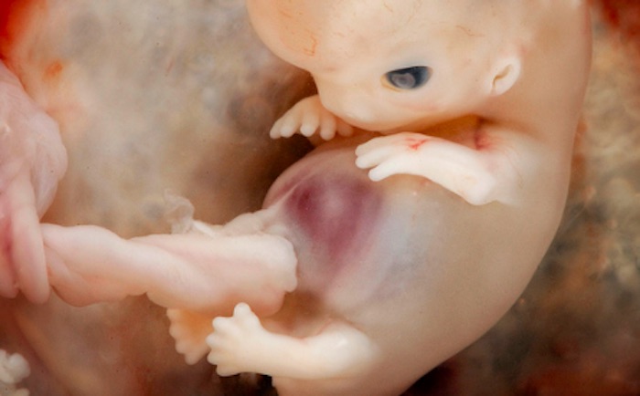 7 8 Week Embryo.jpg