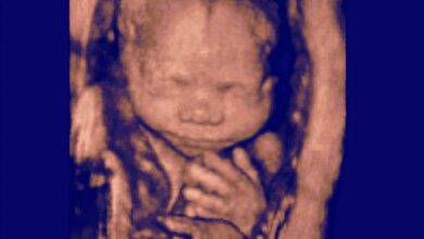 Gettyimages 151056179 Fetus 24 Weeks Ultrasound.jpg