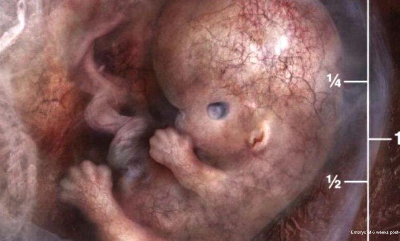 Embryo 6 Weeks Post Fertilization.jpg