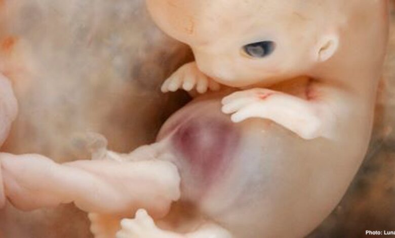 Fetus First Trimester.jpg