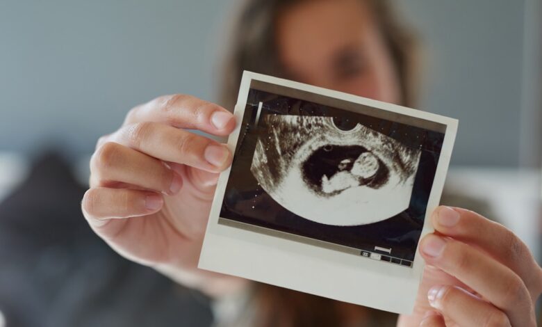 Gettyimages 888921376 Ultrasound.jpg