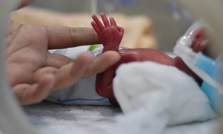 New Born Baby Treated In Incubator. 1411822518 1258x838.jpeg