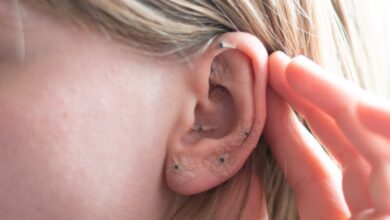 Woman Shows Acupuncture On The Ear.jpeg