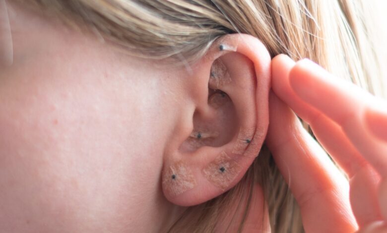 Woman Shows Acupuncture On The Ear.jpeg