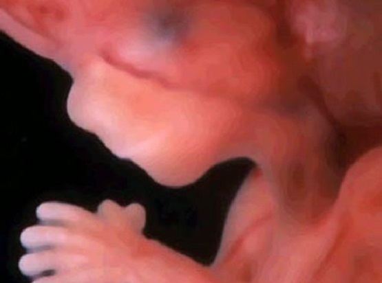 Ultrasound3d23.jpg