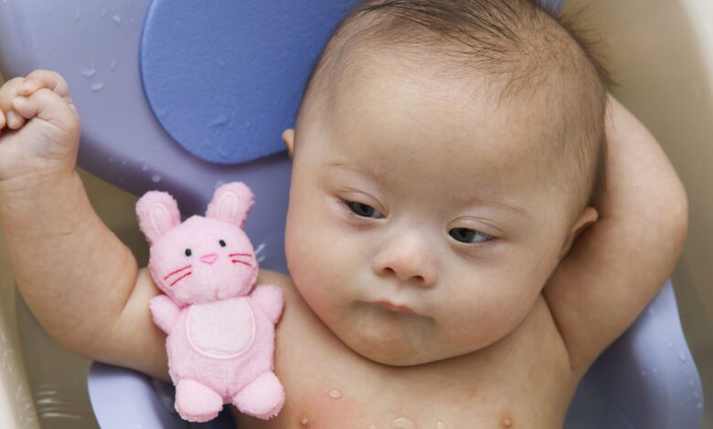 Gettyimages 500783071 Baby Down Syndrome.jpg